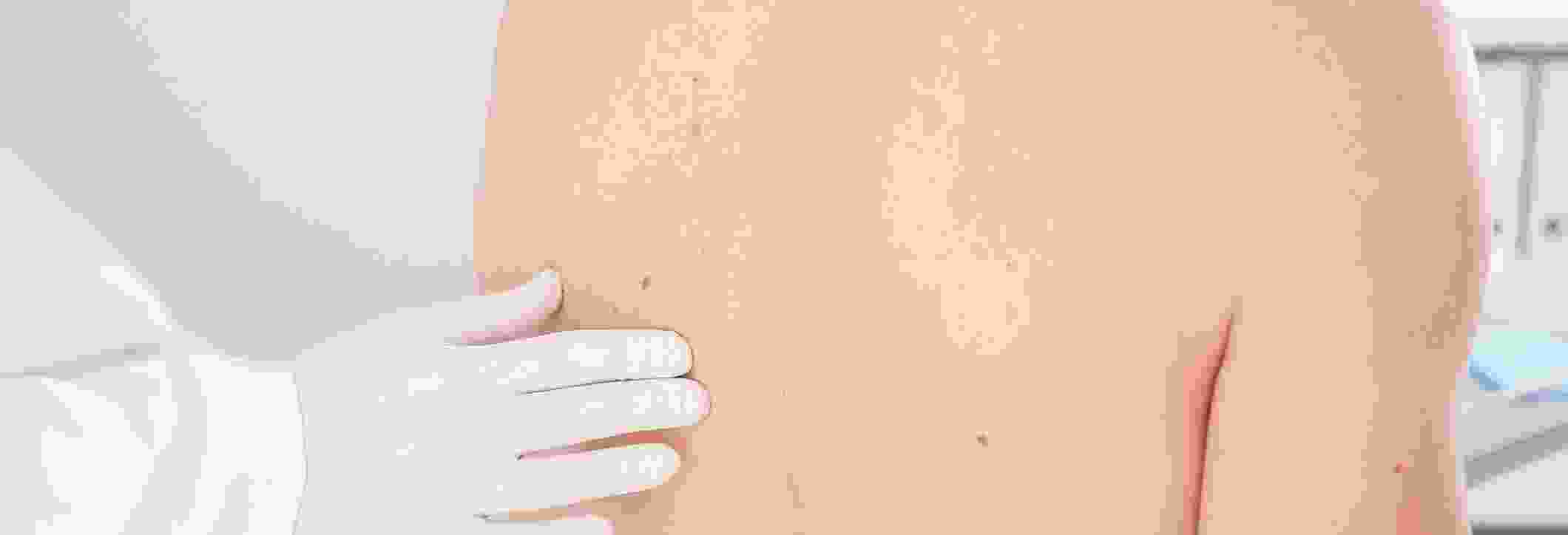 dermatocare.ca